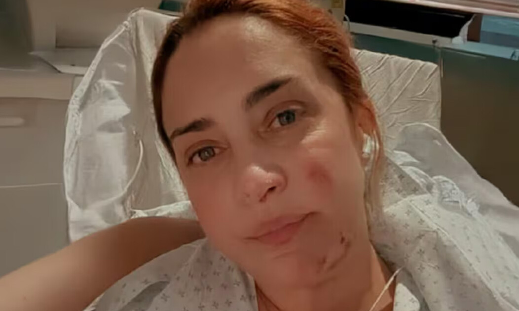 Las impactantes fotos de María Julia Oliván de cómo le quedó su cuerpo tras quemarse viva: “No se asusten”